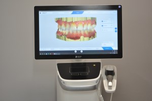 Digital scan on teeth utilizing Digital Imaging and CEREC technology